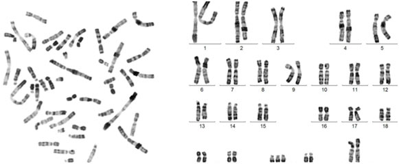 Chromosomes-organisms